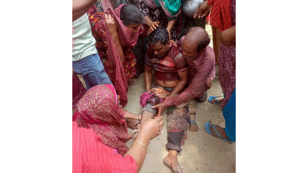 দৌলতপুরে দুর্বৃত্তদের হামলায় গুলিবিদ্ধ যুবক হাসপাতালে