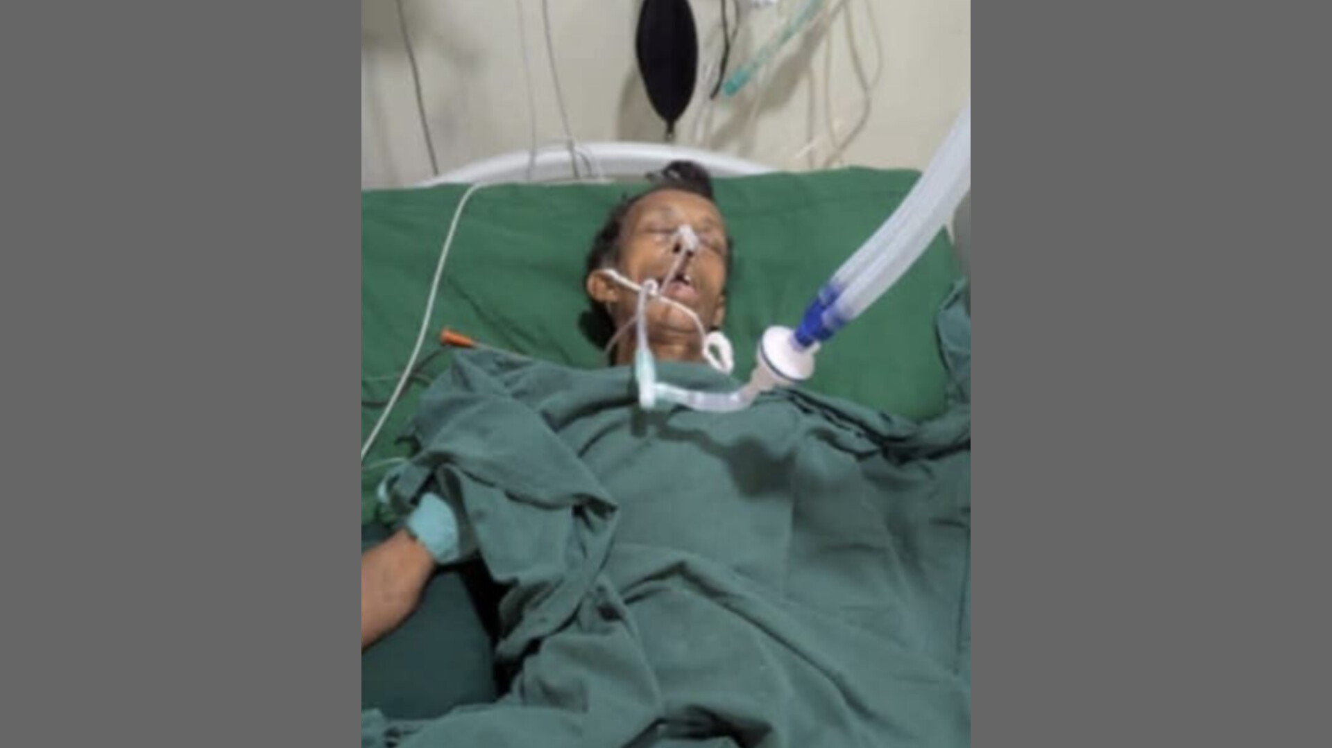 বোয়ালখালীতে সড়ক দুর্ঘটনায় আহত বৃদ্ধের চিকিৎসাধীন অবস্থায় মৃত্যু