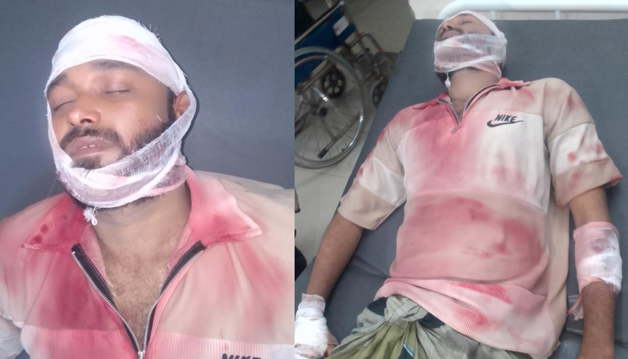 মিরসরাইয়ে মিঠাছড়ায় ব্যাটারি চুরি কেন্দ্র করে সংঘর্ষ  মধ্যস্থতা করতে গিয়ে যুবদল কর্মীকে কুপিয়ে জখম, বাইকে আগুন