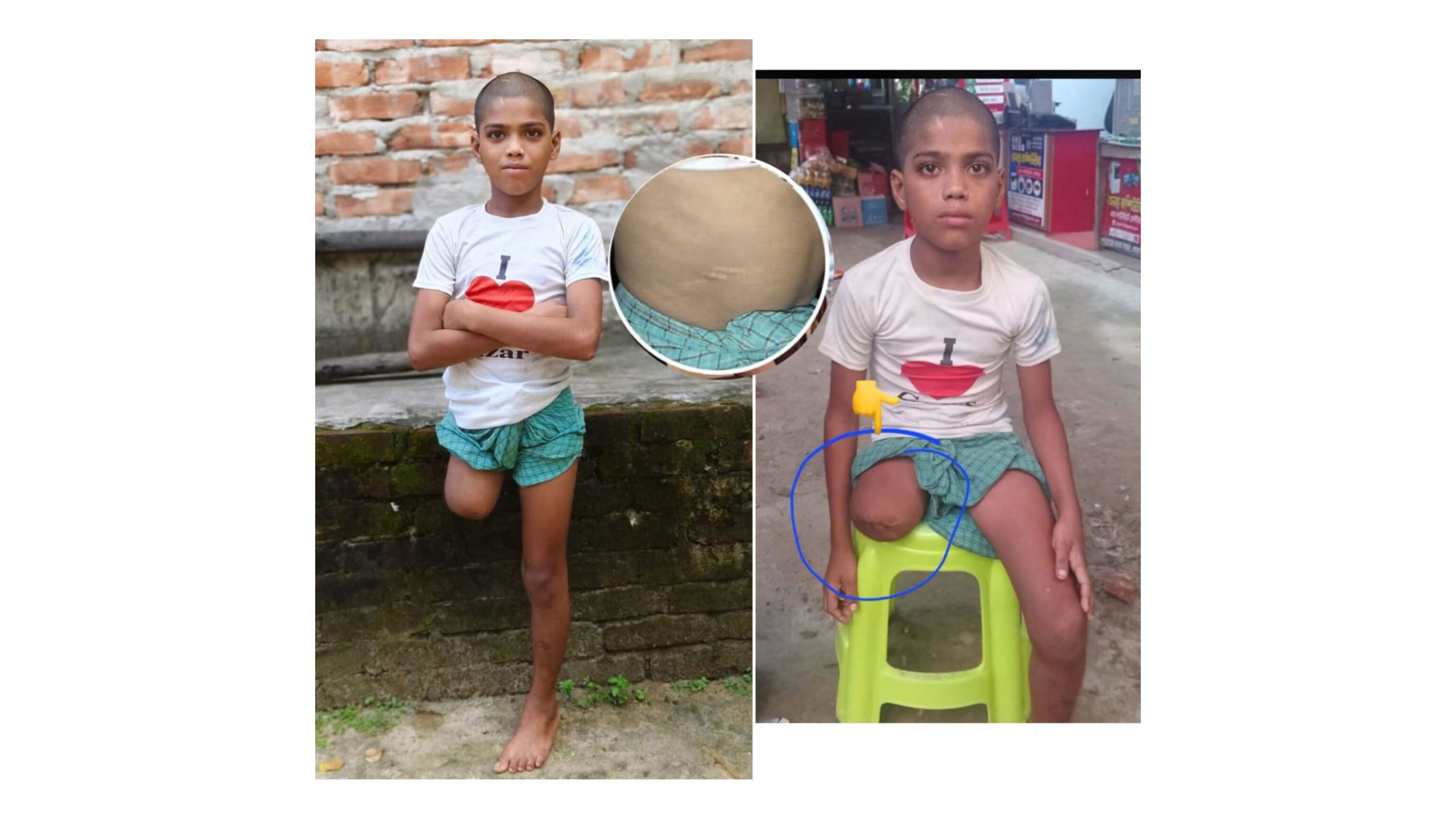 ৭ মাস পর চুনতির মাহফিলে নিখোঁজ রায়হানের সন্ধান, পা হারিয়ে ভিক্ষা করছিল ১২ বছরের শিশু